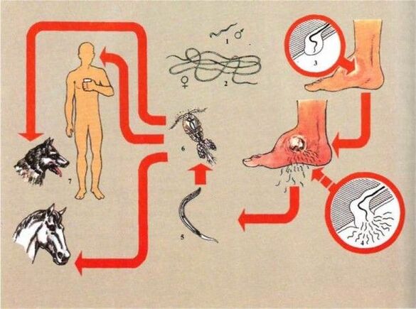 Razvoj dracunculiasis